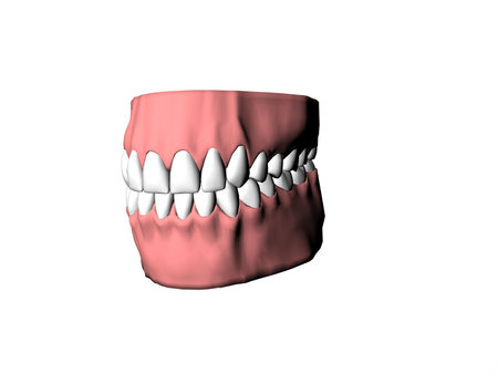 Isolated dentures