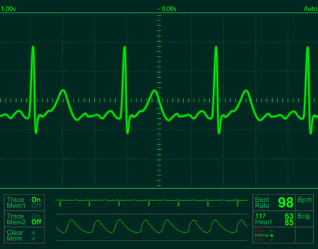 heart monitor screen with normal beat signal