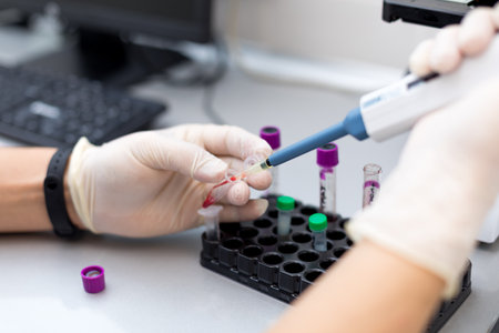 Doctor hand taking a blood sample with analyser in the lab backgroundの写真素材