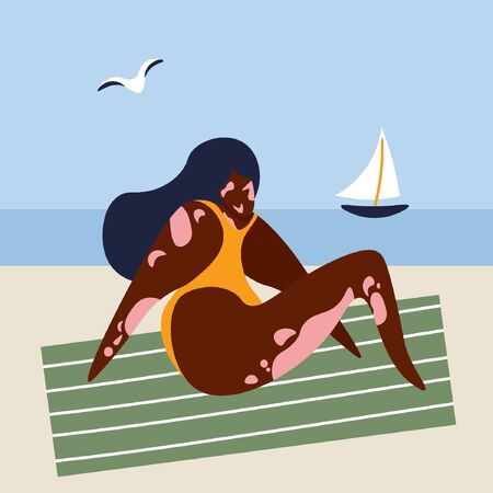 Minimalistic summer illustration with a girl who has vitiligo diseaseのイラスト素材