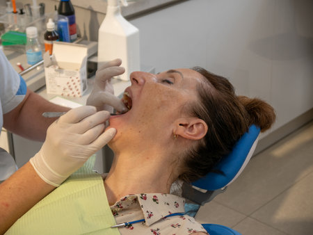 The patient is in the dental chair with her mouth open while the dentist treats her teeth. Photographed in close-up.の写真素材