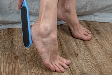 A woman rubs her heels with a double-sided foot grater. The female cleans her feet with a grater, removing calluses from her heels. Pedicure tool. Foot care. Womens health conceptの写真素材