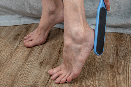 The female uses a sanding brush to exfoliate her foot. Treatment of cracked heels in women. A woman makes cosmetic procedures with a plastic grater for the skin of the heels. Callus removal conceptの写真素材
