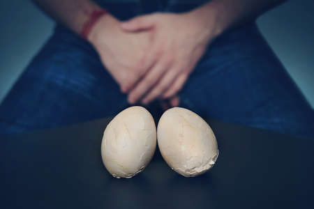 Chicken eggs and Shell eggs symbol penis. Excruciating pain in the groin. The concept of male sexual problems.の写真素材