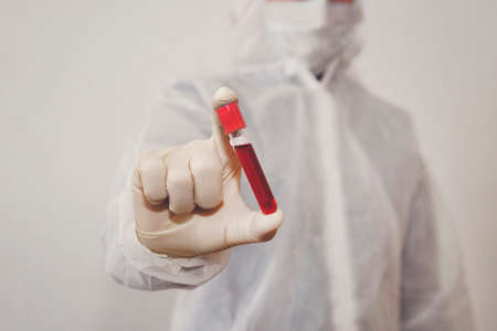 Doctor holding a bottle of blood sample . Laboratory blood tests. Concepts of medicine and...