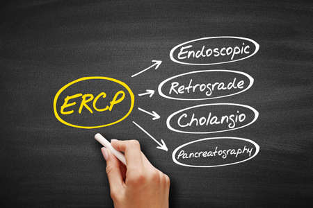 ERCP - Endoscopic Retrograde CholangioPancreatography acronym, concept on blackboardの写真素材
