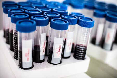 Test tubes with blood. Coronavirus test