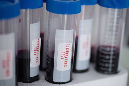 Test tubes with blood. Coronavirus testの写真素材