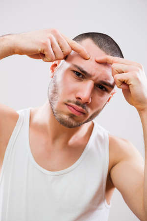 Young man is squeezing pimple on his forehead.の写真素材