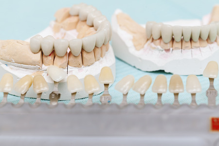 dental prostheses and ceramic covers for teethの写真素材