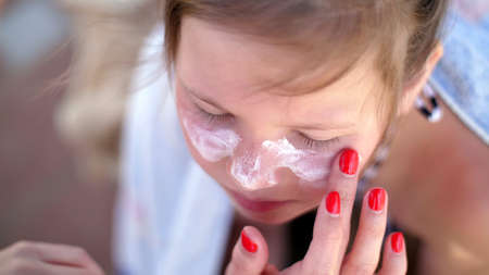 close-up, the child, girls, severe sunburn on the face. Mom smears places of burns abundantly with a...