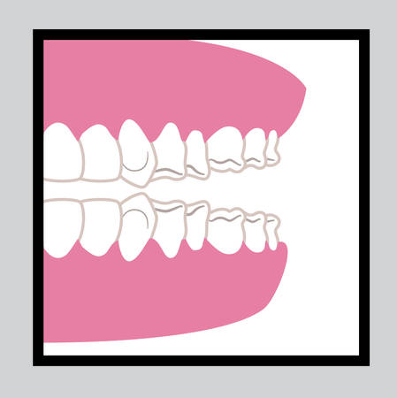 Dental design over gray background, vector illustration