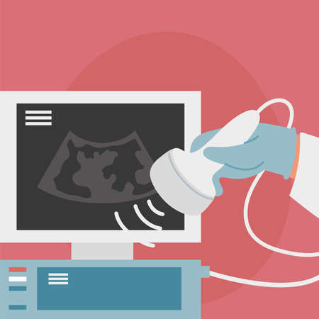 ultrasonographic examination machine gynecology conceptのイラスト素材
