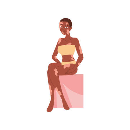 afro woman with vitiligoのイラスト素材