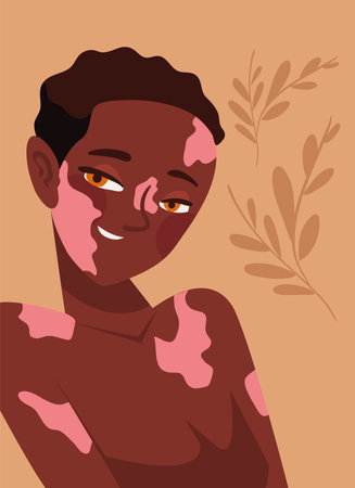 afro woman with vitiligoのイラスト素材