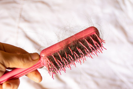 in the male hand is a red comb with a lot of dark brown hair on it, male pattern baldness associated...