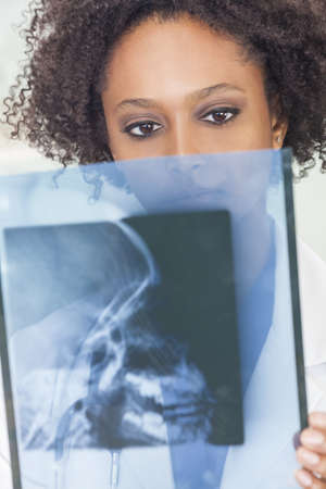 An African American female woman medical doctor with a an x-ray in hospital
の写真素材