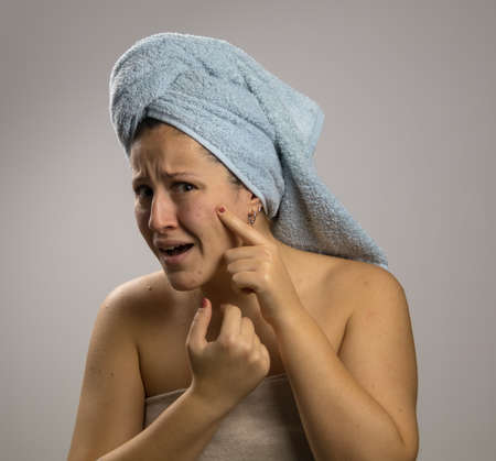 Girl after bathing with a towel and scared, points to the pimples on her faceの写真素材