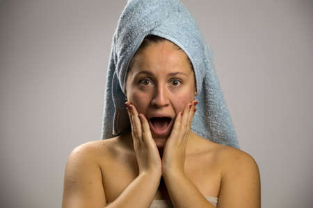Young woman after bathing with a towel and scared and sad, points to the pimples on her faceの写真素材