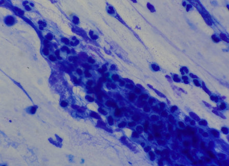 Mycobacterium tuberculosis appearance under the microscope is red with AFB staining