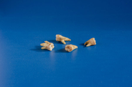 A close-up of spoiled molars. Eye level shooting. Selective focus.