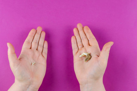 Female hands showing teeth of the same animal in different stages of life. Two molars of one dog. A...