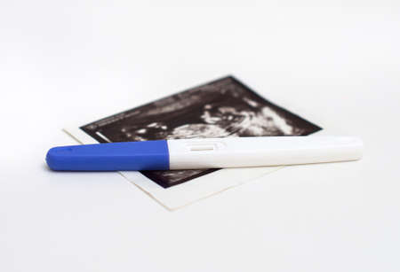 Plastic pregnancy test and ultrasound picture.の写真素材