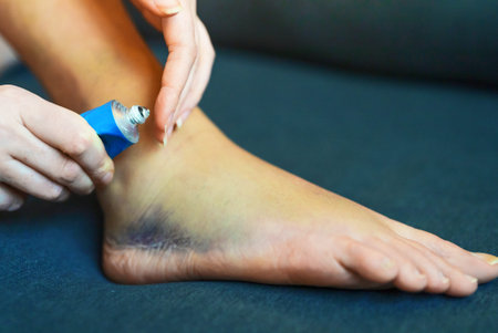Woman applies gel to her injured leg.
