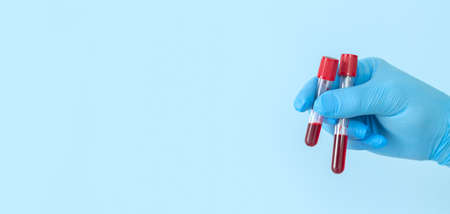 Researcher holding blood sample flasks of patients in laboratory. Banner with copy spaceの写真素材
