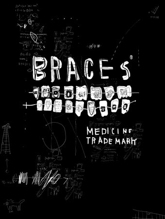 The symbolic image of braces that are placed on the teeth to correct