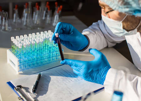 Researcher looking on diseased blood sample in test tube. Focus on test tube.