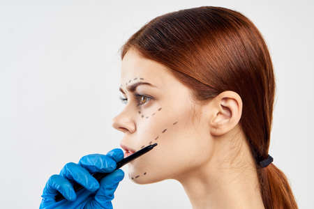 Portrait, plastic surgery.の写真素材