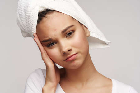Girl with a towel on her head acne on her face healthの写真素材
