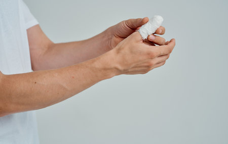 man with broken thumb health problems medicine patientの写真素材