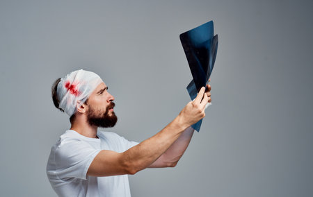 a man with a bandaged head blood resuscitation surgery model gauze on his armの写真素材