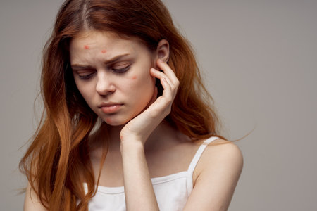 woman with loose hair pimples on face acne gesturing with hands Copy Spaceの写真素材