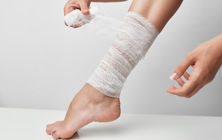 summer injury female leg bandage health problems painの写真素材
