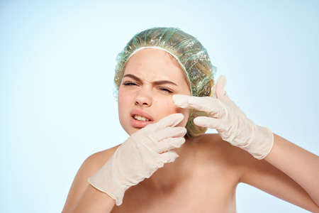 woman with bare shoulders squeeze pimples on her face dermatology