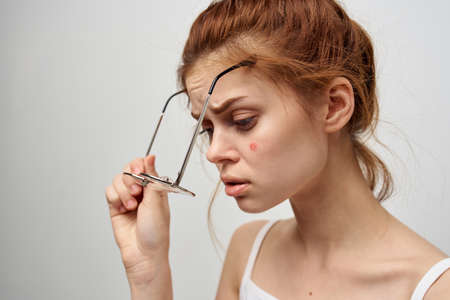 woman with a pimple on the face hygiene treatmentの写真素材
