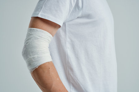 male patient in a white T-shirt with a bandaged hand light backgroundの写真素材
