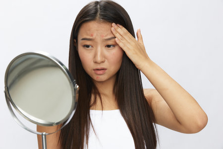 Asian woman with mirror in hand facial skin problems, acne and inflammation, red rash and allergies, chicken pox, sadness from rashes. Facial skin care concept for diseases and nervesの写真素材