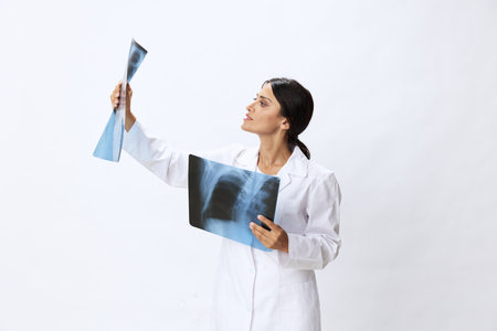 Woman doctor holding X-ray in robe on white background, consequences pneumonia and lung damage, concept of healthの写真素材