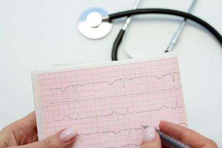 Woman doctor hands holding cardiogram chart. Heart rate measure document, arrhythmia conceptの写真素材