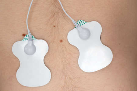 ECG electrodes on the patient. ECG sensors for Electrocardiography