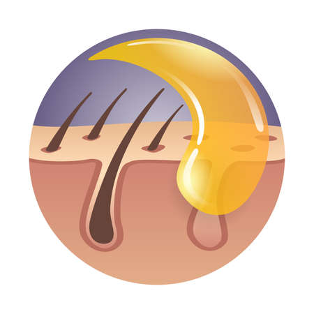 Sugaring - Persian sugar waxing, hair removal method using hot wax. Vector illustrationのイラスト素材