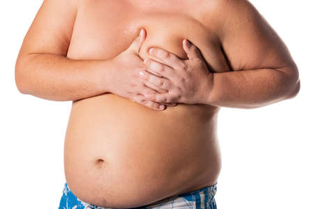Fat man with big belly. Health problems. Obesity, a heartattackの写真素材