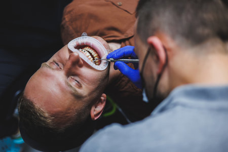 Dental treatment of teeth. A young man at a dentist's appointment. The doctor installs metal braces...