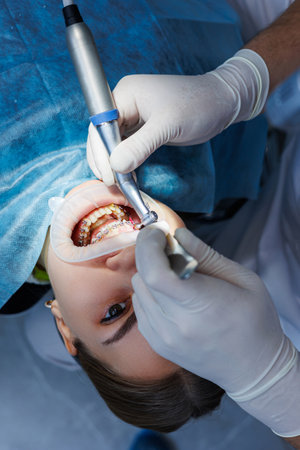 Dentist with dental instruments, examining patient's teeth in dental clinic office. The concept of medicine, dentistry and healthcare. Dental equipment. selective focusの写真素材