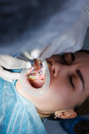 Dentist with dental instruments, examining patient's teeth in dental clinic office. The concept of medicine, dentistry and healthcare. Dental equipment. selective focusの写真素材