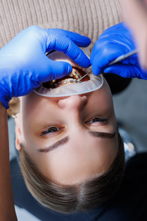 A woman's teeth with metal braces are being treated at the clinic. An orthodontist uses dental instruments to place braces on a patient's teeth. Selective focusの写真素材